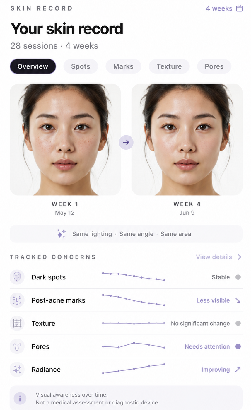 BEAUER app — skin record: week one versus week four comparison and tracked-concern trends